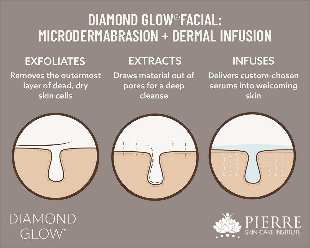 Discover the three steps of DiamondGlow for microdermabrasion at Thousand Oaks' Pierre Skin Care Institute.